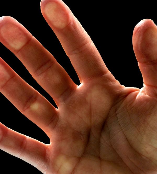 As global press freedom dwindles, corrupt politicians rejoice image